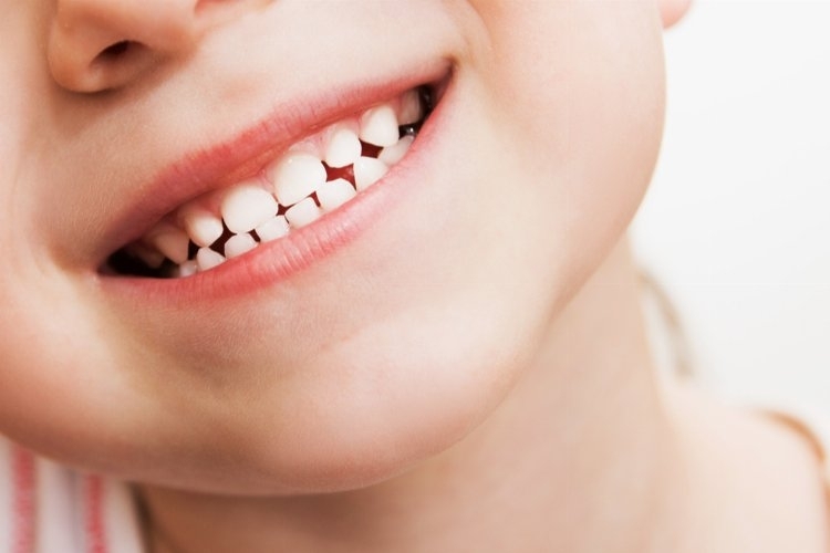 Çocuklarda Diş Çürüğü: Nedenleri ve Dikkat Edilmesi Gerekenler